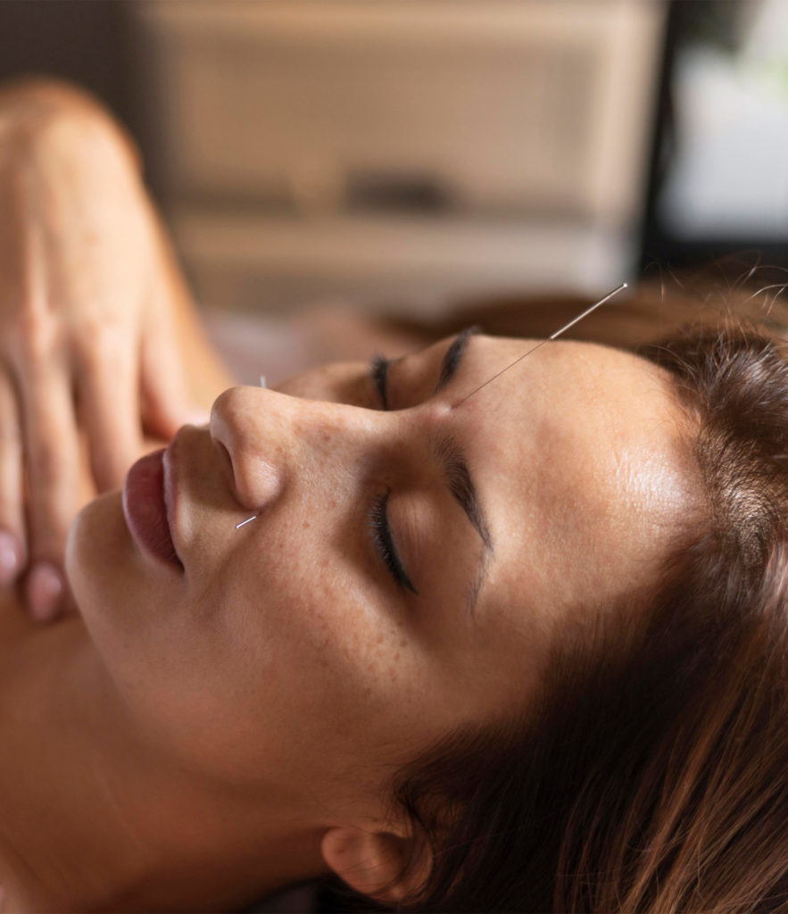 Acupuntura Shin | Salud Natural y Bienestar